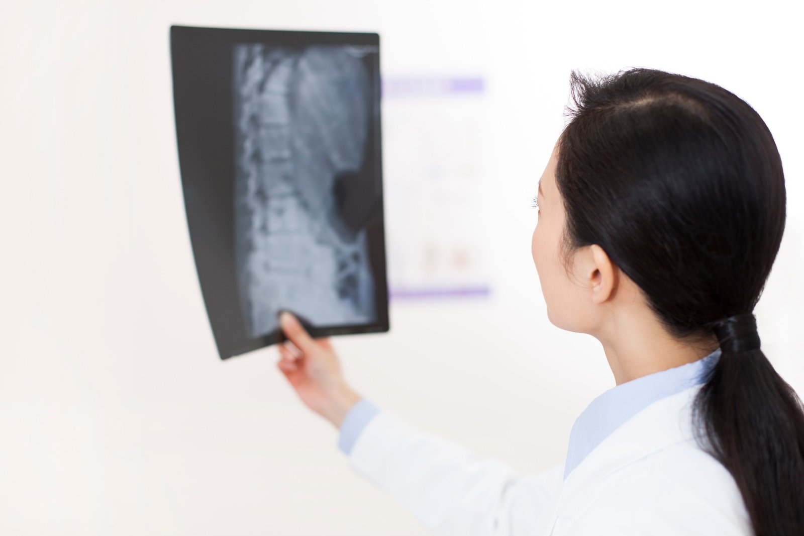 Doctor with x-ray image
