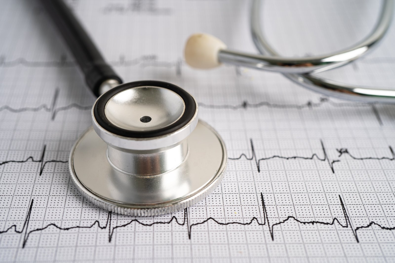Stethoscope on electrocardiogram ECG, heart wave, heart attack, cardiogram report.
