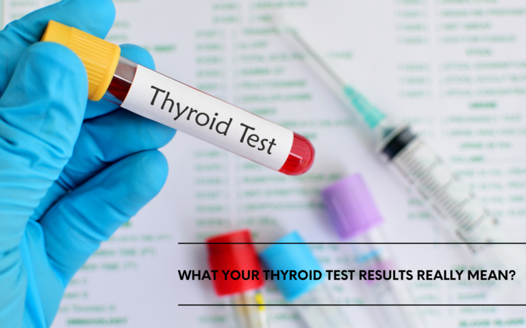 What Your Thyroid Test Results Really Mean?