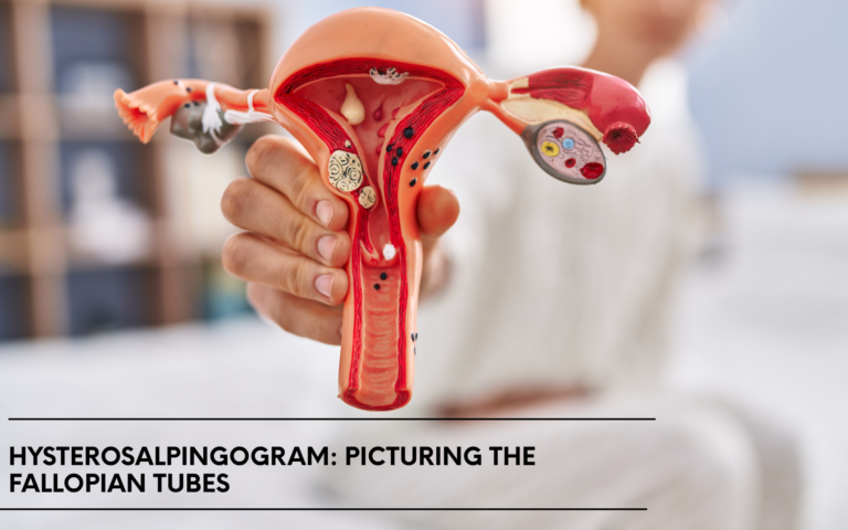 Hysterosalpingogram: Picturing the Fallopian Tubes